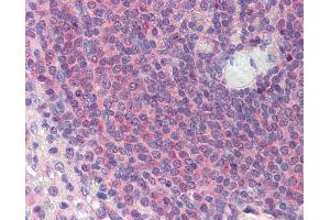 TGFB1I1 antibody  (N-Term)
