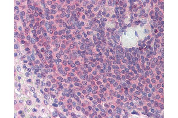 TGFB1I1 antibody  (N-Term)