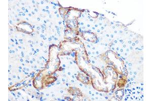 Immunohistochemistry of paraffin-embedded Mouse kidney using YTHDF2 antibody (ABIN7271427) at dilution of 1:100 (40x lens). (YTHDF2 antibody  (AA 1-200))