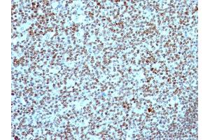 Immunohistochemistry (IHC) image for anti-Nucleolin (NCL) antibody (ABIN6940176)