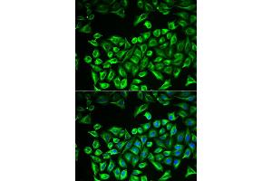 Immunofluorescence analysis of A549 cells using HAS3 antibody. (HAS3 antibody)
