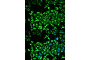 Immunofluorescence analysis of A549 cells using HAS3 antibody. (HAS3 antibody)