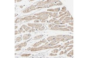 Immunohistochemical staining of human heart muscle with TRIOBP polyclonal antibody  shows moderate cytoplasmic positivity in myocytes.