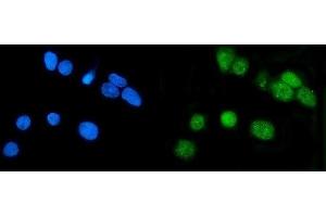 IF analysis of LSM7 using anti-LSM7 antibody (ABIN7598937). (LSM7 antibody  (AA 1-103))