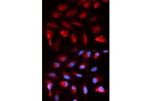 Immunofluorescence analysis of U2OS cells using PPARD antibody (ABIN5973301). (PPARD antibody)