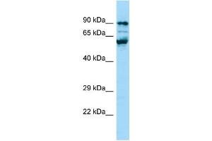 WB Suggested Anti-PPIG Antibody Titration: 1. (PPIG antibody  (C-Term))