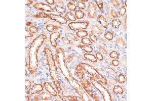 Immunohistochemistry of paraffin-embedded rat kidney using CYB5A antibody (ABIN6130832, ABIN6139296, ABIN6139297 and ABIN6221049) at dilution of 1:100 (40x lens). (CYB5A antibody  (AA 1-100))