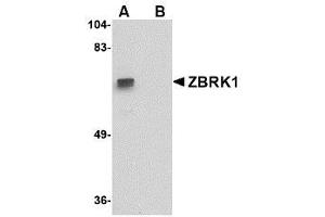 Image no. 1 for anti-Zinc Finger Protein 350 (ZNF350) (C-Term) antibody (ABIN342727)