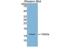 Figure. (High Temperature Requirement Factor A1 (AA 304-442) antibody)