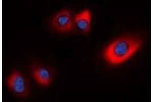 Immunofluorescent analysis of HSP20 (pS16) staining in HEK293T cells. (HSPB6 antibody  (N-Term, pSer16))
