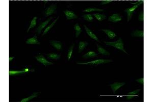 Immunofluorescence of monoclonal antibody to RPS6KA1 on HeLa cell.