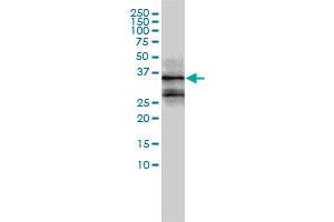Western Blotting (WB) image for anti-FOS-Like Antigen 2 (FOSL2) (AA 1-122) antibody (ABIN560942)