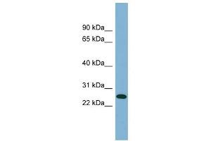ITGB1BP3 antibody used at 1 ug/ml to detect target protein. (ITGB1BP3 antibody  (Middle Region))