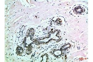 Immunohistochemical analysis of paraffin-embedded Human-breast, antibody was diluted at 1:100 (EPH Receptor B3 antibody  (AA 650-700))