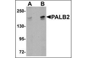 Western blot analysis of PALB2 in SK-N-SH cell lysate with this product at (A) 1 and (B) 2 μg/ml. (PALB2 antibody  (C-Term))