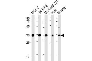 Western Blotting (WB) image for anti-Wingless-Type MMTV Integration Site Family, Member 4 (WNT4) (AA 30-351) antibody (ABIN6243296)