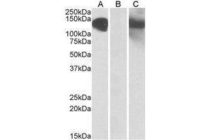 HEK293 lysate (10µg protein in RIPA buffer) overexpressing Human CDH11 with C-terminal MYC tag probed with AP21503PU-N (1µg/ml) in Lane A and probed with anti-MYC Tag (1/1000) in lane C. (OB Cadherin antibody  (Internal Region))