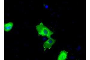 Image no. 7 for anti-Bruton Agammaglobulinemia tyrosine Kinase (BTK) antibody (ABIN1496976) (BTK antibody)