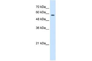 WB Suggested Anti-CCT8 Antibody Titration:  0.