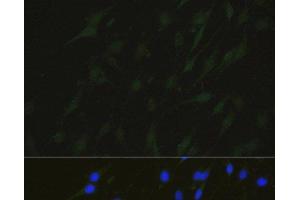 Immunofluorescence (IF) image for anti-Nonhomologous End-Joining Factor 1 (NHEJ1) antibody (ABIN7261171)