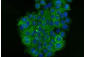 IF analysis of Cytokeratin 5 using anti-Cytokeratin 5 antibody (ABIN7602992).