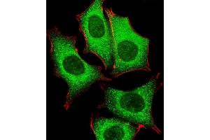 Fluorescent image of MCF-7 cells stained with GLD2 Antibody (N-term) (ABIN651284 and ABIN2840170).
