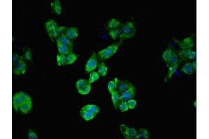 Immunofluorescent analysis of PC-3 cells using ABIN7174771 at dilution of 1:100 and Alexa Fluor 488-congugated AffiniPure Goat Anti-Rabbit IgG(H+L) (C19orf48 antibody  (AA 1-117))