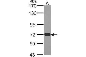 WB Image Sample (30 ug of whole cell lysate) A: JurKat 7. (RAD54L antibody  (N-Term))