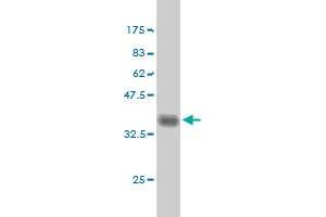 Western Blotting (WB) image for anti-FYN Oncogene Related To SRC, FGR, YES (FYN) (AA 1-90) antibody (ABIN560968)