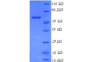 SDS-PAGE (SDS) image for Vinculin (VCL) (AA 2-235), (partial) protein (GST tag) (ABIN1095818)