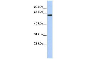 WB Suggested Anti-TBX18 Antibody Titration:  0.