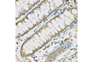 Immunohistochemistry of paraffin-embedded human colon using PDGFB Antibody (ABIN5970539) at dilution of 1/100 (40x lens).