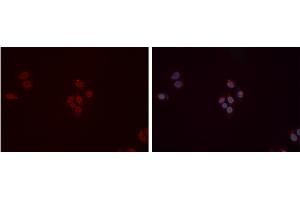 ABIN6277358 staining Hela cells by IF/ICC. (DDB1 antibody  (C-Term))