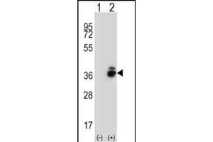 Western blot analysis of CRHBP (arrow) using rabbit polyclonal CRHBP Antibody (N-term) (ABIN656818 and ABIN2846031).