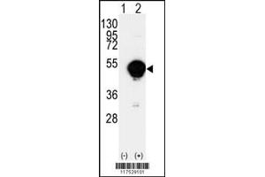 Western blot analysis of CYP20A1 using rabbit polyclonal CYP20A1 Antibody using 293 cell lysates (2 ug/lane) either nontransfected (Lane 1) or transiently transfected with the CYP20A1 gene (Lane 2).