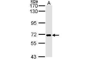 WB Image Sample (30 ug of whole cell lysate) A: H1299 7. (SLC20A1 antibody)