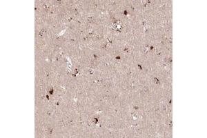 Immunohistochemical staining (Formalin-fixed paraffin-embedded sections) of human cerebral cortex with ARSB polyclonal antibody  shows strong granular cytoplasmic positivity in neuronal cells. (Arylsulfatase B antibody)