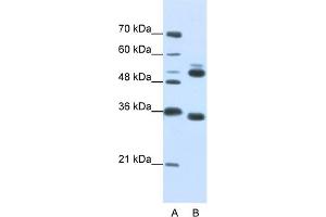WDR6 anticorps  (C-Term)