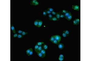 Immunofluorescent analysis of PC-3 cells using ABIN7155729 at dilution of 1:100 and Alexa Fluor 488-congugated AffiniPure Goat Anti-Rabbit IgG(H+L) (HOXA9 antibody  (AA 1-190))