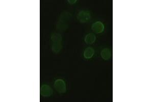 Anti-HHex mouse monoclonal antibody (ABIN2452343) immunofluorescent staining of HeLa cells transiently transfected by pCMV6-ENTRY HHex (RC204815) (HHEX antibody  (AA 100-270))