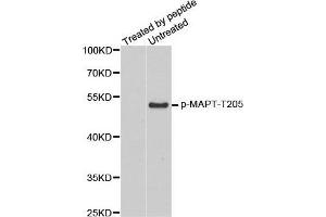 Western Blotting (WB) image for anti-Microtubule-Associated Protein tau (MAPT) (pThr205) antibody (ABIN3019698) (MAPT antibody  (pThr205))