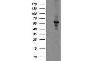 Western Blotting (WB) image for anti-Diphthamide Biosynthesis Protein 2 (DPH2) antibody (ABIN1497894) (DPH2 antibody)