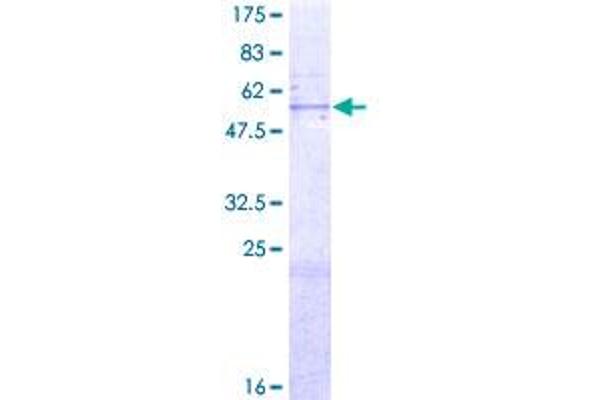 MTA1 Protein (AA 1-255) (GST tag)