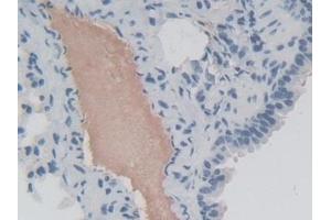 Immunohistochemistry (IHC) image for anti-Eukaryotic Translation Initiation Factor 2-alpha Kinase 3 (EIF2AK3) (AA 973-1114) antibody (ABIN7441241)