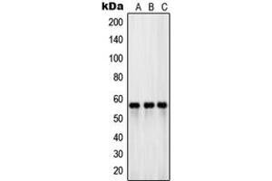 Western blot analysis of EAAT3 expression in PANC1 (A), HeLa (B), human testis (C) whole cell lysates. (SLC1A1 antibody  (Center))