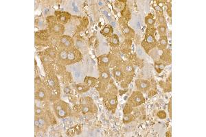 Immunohistochemistry of paraffin-embedded human liver using [KO Validated] RA Rabbit pAb (ABIN3021646, ABIN3021647, ABIN3021648 and ABIN1513457) at dilution of 1:100 (40x lens). (RAB5 antibody  (AA 1-215))