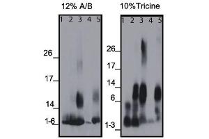 Western blots of the monoclonal antibody binding to different amyloid beta (Abeta) regions of human and mouse protein, using 12% A/B (acrylamide/bisacrylamide) or 10% Tricine matrix. (beta Amyloid antibody  (C-Term))