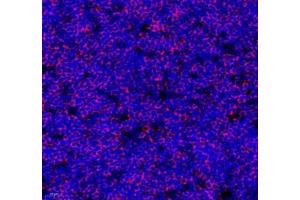 Immunofluorescence (Paraffin-embedded Sections) (IF (p)) image for anti-Linker For Activation of T Cells (LAT) antibody (ABIN7074502)