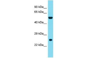 Host: Rabbit Target Name: DNAAF3 Sample Type: Fetal Liver lysates Antibody Dilution: 1. (DNAAF3 antibody  (C-Term))