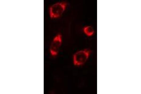 MRPL4 antibody  (Internal Region)
